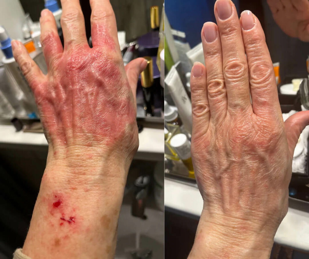 Repair Balm - limitiertes Probierangebot 8 Petra Erfahrung Repair Balm